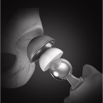 Fluoroscopic Guided Component Positioning 